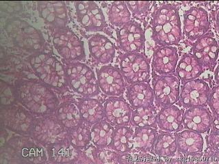 直乙结肠粘膜图37