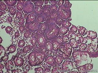 直乙结肠粘膜图7