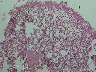 直乙结肠粘膜图19
