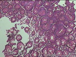 直乙结肠粘膜图8