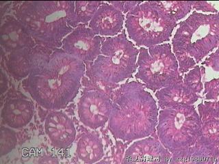 直乙结肠粘膜图30