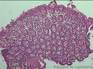 直乙结肠粘膜图12