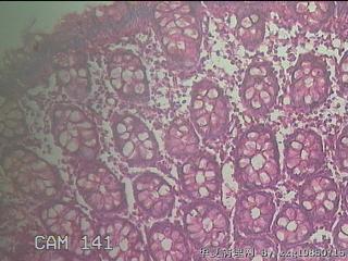 直乙结肠粘膜图38