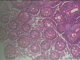 直乙结肠粘膜图33