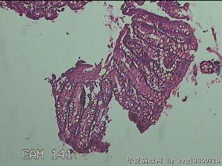 直乙结肠粘膜图11