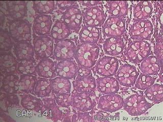直乙结肠粘膜图35