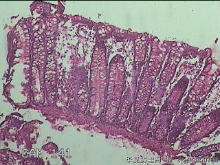 直乙结肠粘膜图14