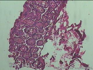 直乙结肠粘膜图16