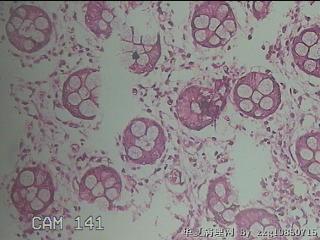 直肠粘膜图41
