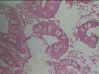 直肠粘膜图31