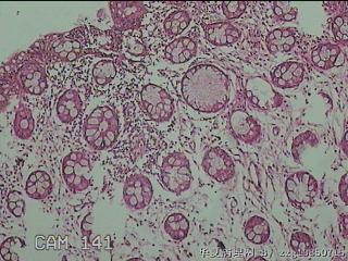 直肠粘膜图2