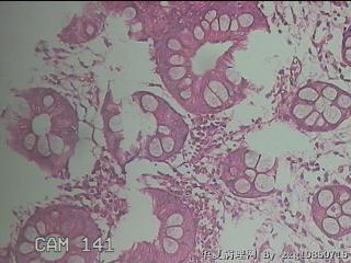 直肠粘膜图45