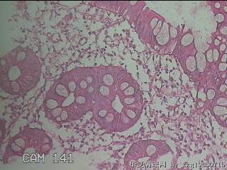 直肠粘膜图48
