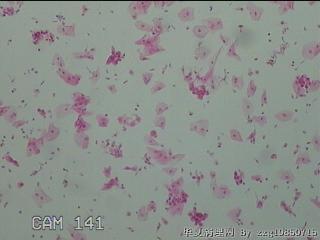 宫颈HPV16阳性图24