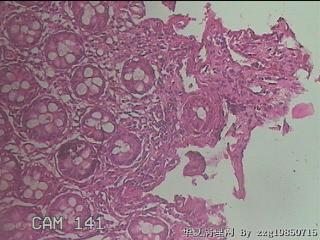 直乙结肠粘膜图25
