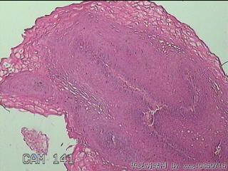 食管粘膜图1