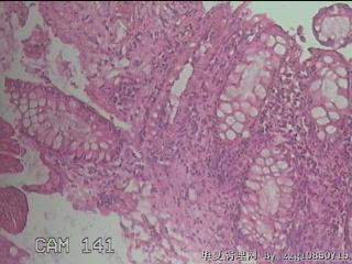 直乙结肠粘膜图19