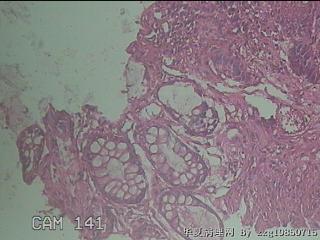 直乙结肠粘膜图23