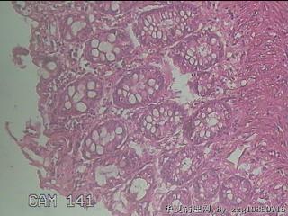 直乙结肠粘膜图16
