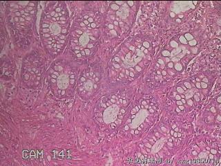 直乙结肠粘膜图5