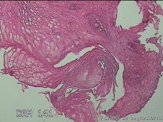 食管粘膜图5