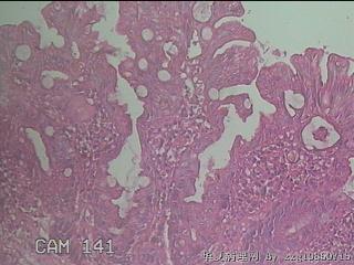 直乙结肠粘膜图21