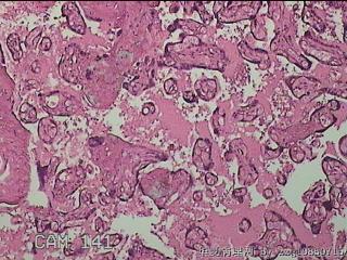胎盘组织图35