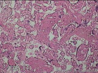 胎盘组织图38