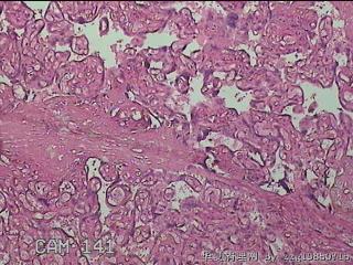 胎盘组织图14