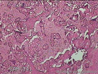 胎盘组织图23