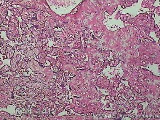 胎盘组织图2