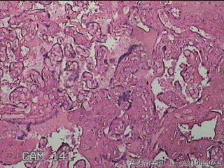 胎盘组织图39