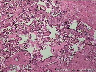 胎盘组织图33
