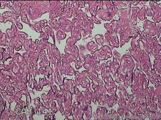 胎盘组织图9
