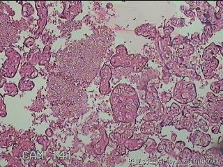 胎盘组织图15