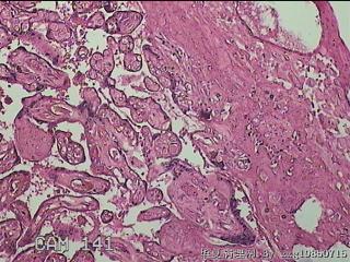 胎盘组织图34