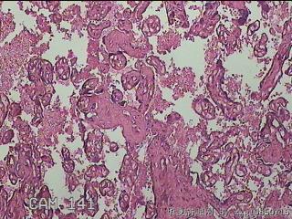 胎盘组织图30