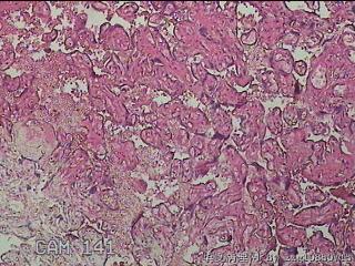 胎盘组织图10