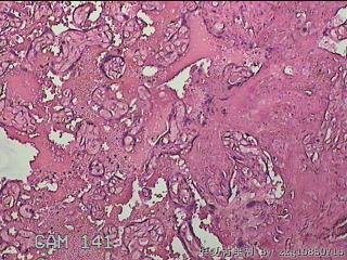 胎盘组织图36