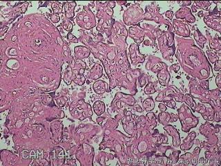 胎盘组织图13