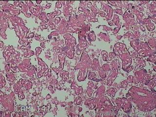 胎盘组织图25