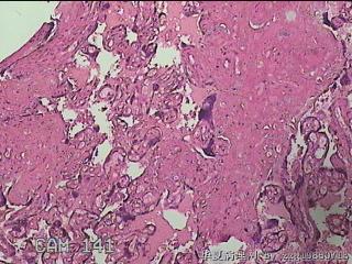 胎盘组织图37