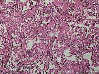胎盘组织图26