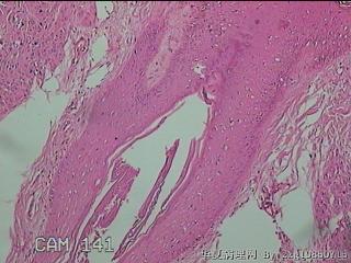 面部和背部皮肤赘生物图15