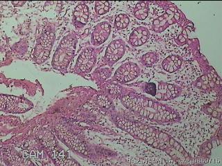 直乙结肠粘膜图19