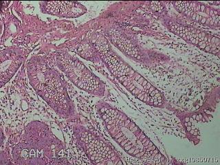 直乙结肠粘膜图18