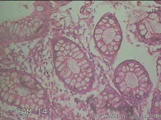 直乙结肠粘膜图30