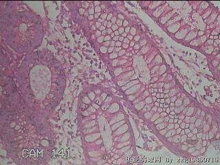 直乙结肠粘膜图38