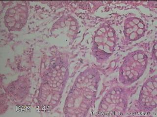 直乙结肠粘膜图40