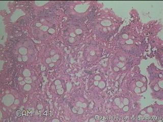 直乙结肠粘膜图22